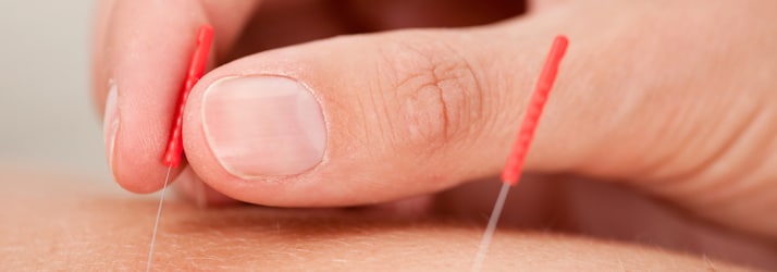 page-acupuncture3 acupuncture 2